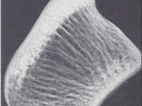 Das Strahlbein, Röntgenaufnahme