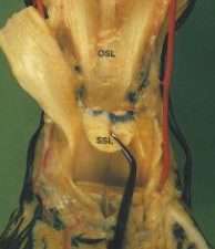 Hufrolle - anatomische Strukturen