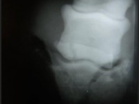 Röntgenbild1