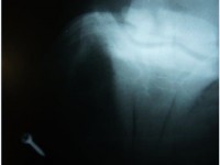 Röntgenbild4